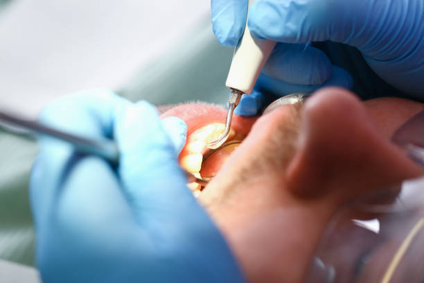 Best Emergency Cosmetic Dentistry in Gilroy, CA